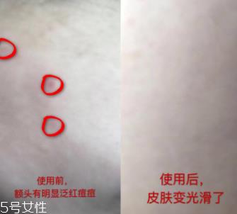 资生堂红腰子适合什么年龄？最适合30岁以下人群