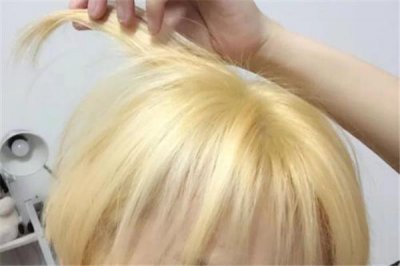 ​漂发后头皮结痂用什么药 漂发后头皮结痂会秃吗