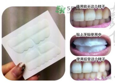 ​smile cosmetique牙贴怎么样_有效果吗_多少钱
