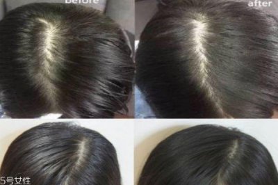 ​碧缇丝免洗喷雾有害吗 只能用来急救解决小尴尬