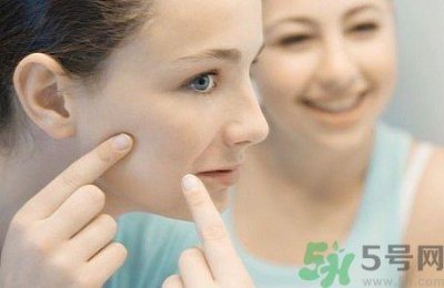 ​脸上有痘印怎么去除？去除痘印的小妙方？