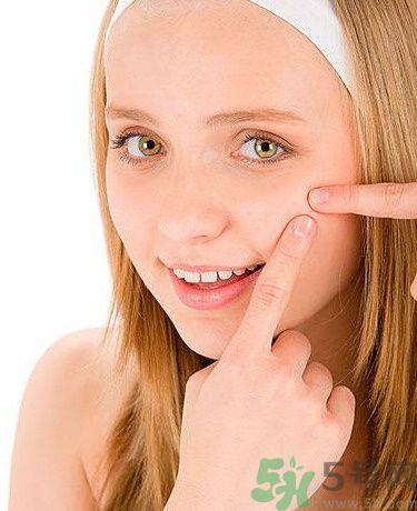 脸上有痘印怎么去除？去除痘印的小妙方？