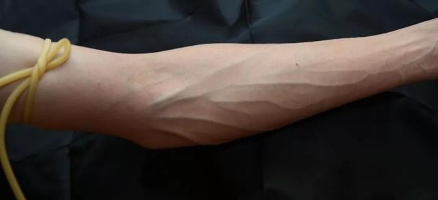 蓝血人种在哪儿(猎奇杂志里的蓝血人可能存在吗)